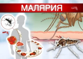 Малярия Малярия.